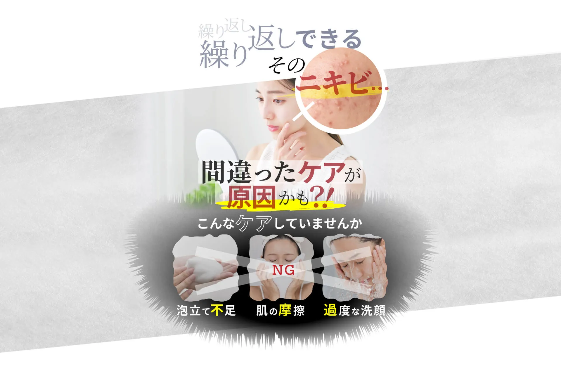 そのお悩み間違ったニキビケアをしているせいかも！？