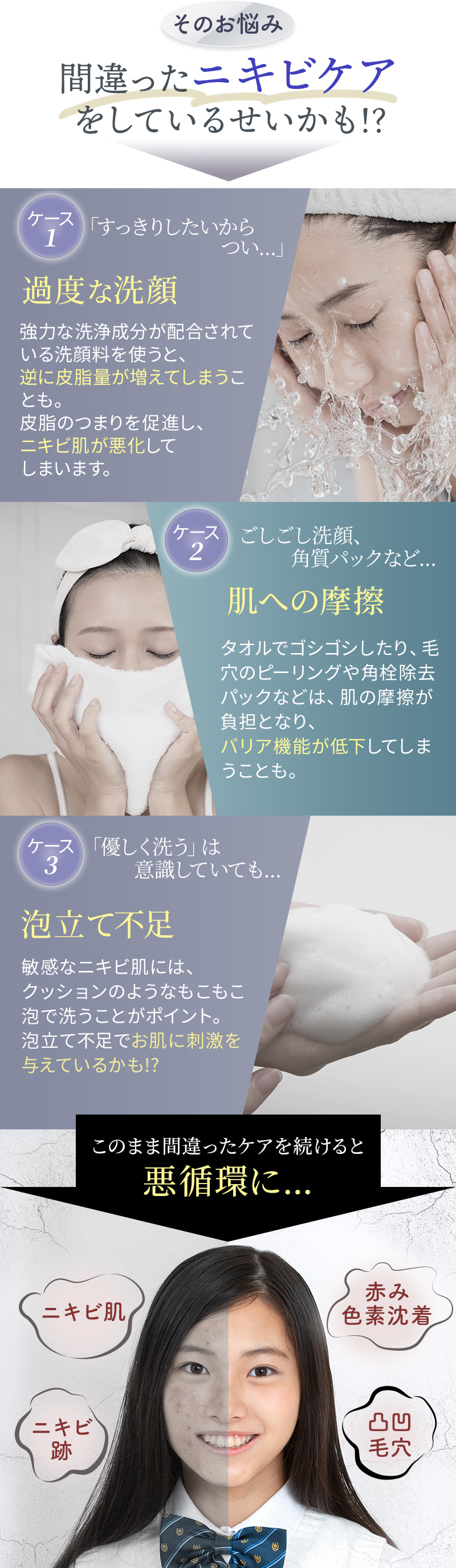 そのお悩み間違ったニキビケアをしているせいかも！？